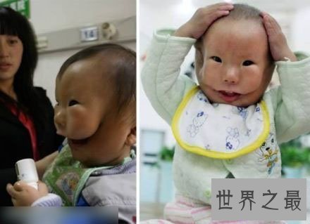 【图】世界10个领有多余性器官的人，双阴DAO双阴茎四个