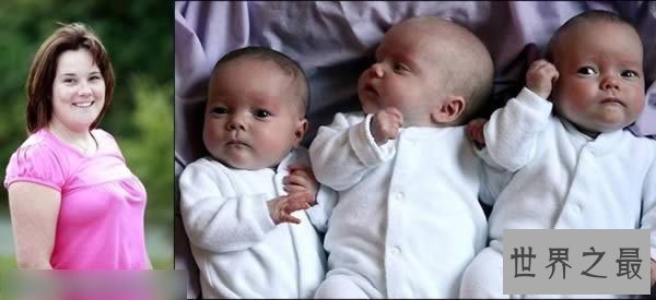 【图】世界10个领有多余性器官的人，双阴DAO双阴茎四个