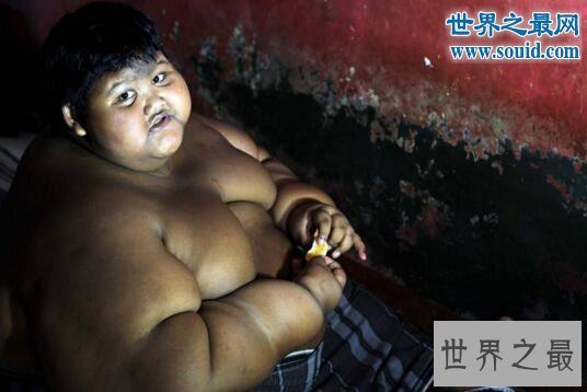 【图】世界上最胖的男孩，印尼男孩年仅10岁重达384斤
