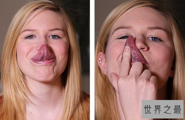 【图】世界上体毛最长的人，艾米丽.苏珊(人类返祖现象