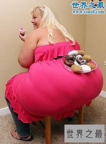 【图】世界上体毛最长的人，艾米丽.苏珊(人类返祖现象