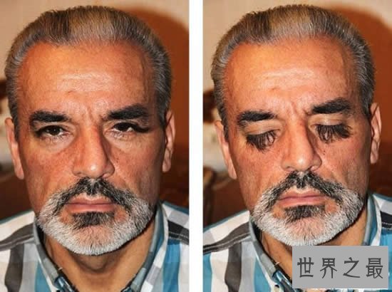 【图】世界上体毛最长的人，艾米丽.苏珊(人类返祖现象