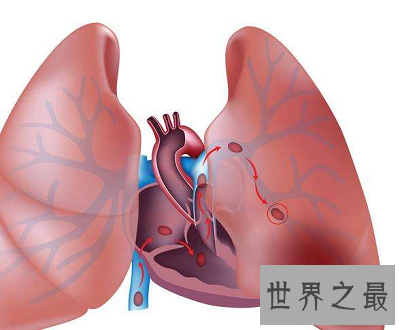 【图】肝功能异常最常见表现有哪些 肝功能异常怎么办
