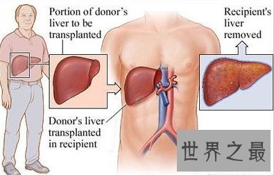 【图】你知道你的肝在哪吗 快来看看最具体肝的位置图