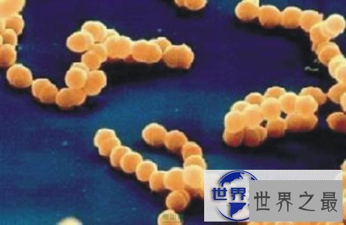 【图】荨麻疹早期症状，最佳的治疗方法，如何预防荨