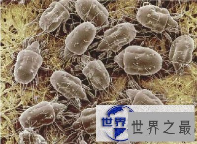 【图】知道脸上痘痘的罪魁祸首是螨虫，但是你见过螨