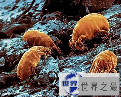 【图】知道脸上痘痘的罪魁祸首是螨虫，但是你见过螨