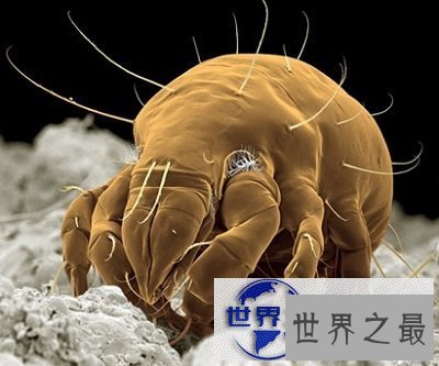 【图】知道脸上痘痘的罪魁祸首是螨虫，但是你见过螨