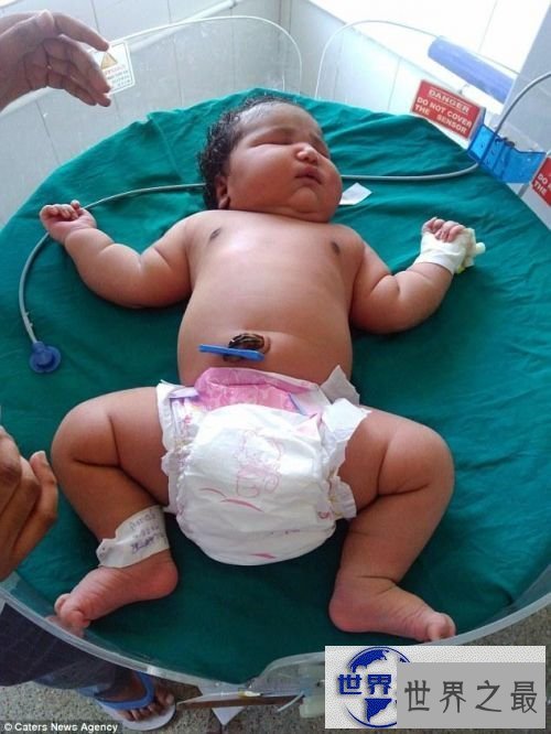 【图】世界上最重的女婴,印度19岁女孩生13.6斤重巨婴