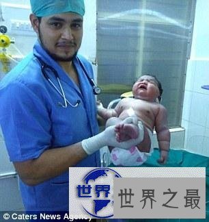 【图】世界上最重的女婴,印度19岁女孩生13.6斤重巨婴