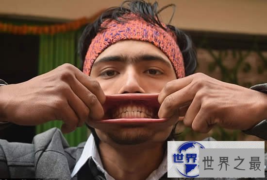 【图】最新世界第一大嘴，尼泊尔男子嘴巴插进138支铅