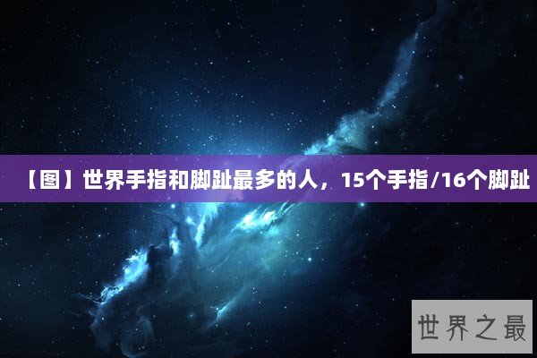 【图】世界手指和脚趾最多的人,15个手指/16个脚趾 【图】世界手指和脚趾最多的人,15个手指/16个脚趾